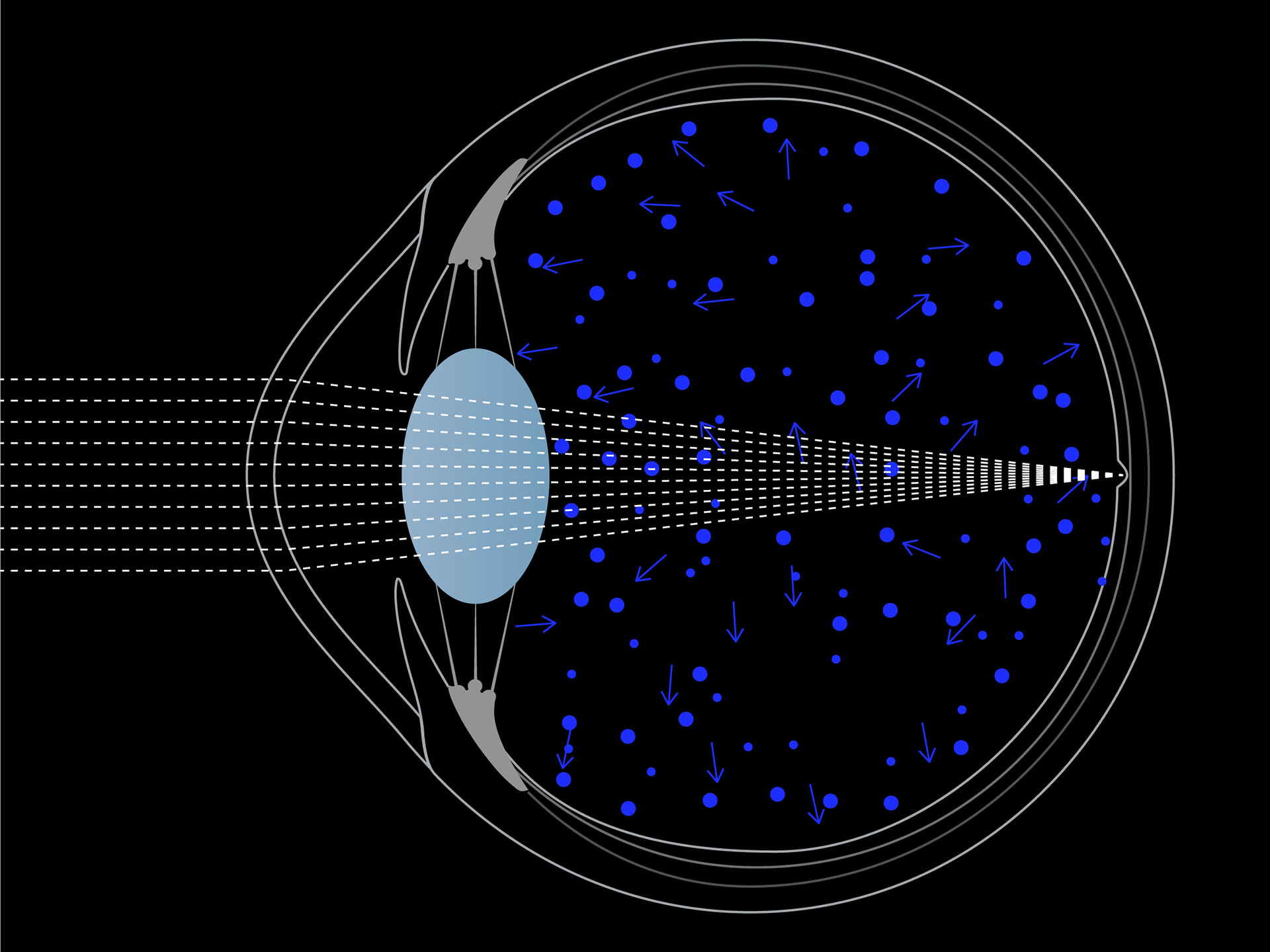 Schematisk visualisering av blått ljus i ögat.