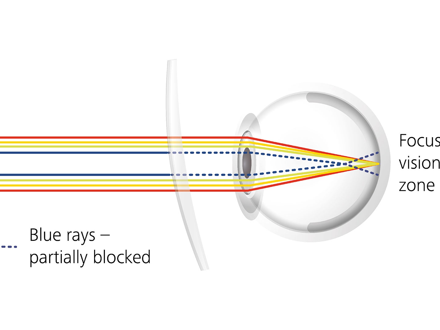Visualisering över hur glasytbeläggningar kan reducera bländning geno att delvis blockera blåstrålar 