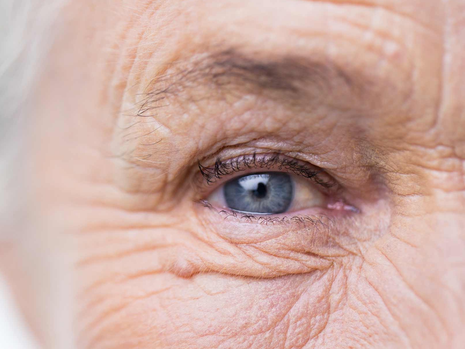 Bilden visar en närbild av ett ohälsosamt öga som illustrerar potentiella okulära kopplade risker. 